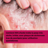 EXCIPIAL U10 LIPOLOTION 200ML – Image 2